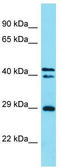 Helt BHLH Transcription Factor antibody, TA329607, Origene, Western Blot image 