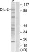 TPX2 Microtubule Nucleation Factor antibody, TA312749, Origene, Western Blot image 