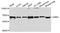 Glutaminase antibody, A01272, Boster Biological Technology, Immunohistochemistry paraffin image 