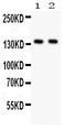Jagged Canonical Notch Ligand 2 antibody, PB9255, Boster Biological Technology, Western Blot image 