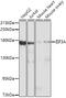 Centrosomin antibody, GTX32578, GeneTex, Western Blot image 