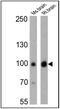 Discs Large MAGUK Scaffold Protein 4 antibody, MA1-046, Invitrogen Antibodies, Western Blot image 