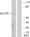 Glycerate Kinase antibody, LS-C119132, Lifespan Biosciences, Western Blot image 