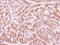 Fanconi anemia group E protein antibody, NBP2-16428, Novus Biologicals, Immunohistochemistry paraffin image 