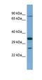 Sodium- and chloride-dependent glycine transporter 1 antibody, orb325037, Biorbyt, Western Blot image 