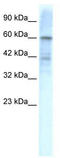 Potassium Voltage-Gated Channel Subfamily D Member 3 antibody, TA338548, Origene, Western Blot image 