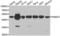 26S protease regulatory subunit 8 antibody, LS-C335163, Lifespan Biosciences, Western Blot image 
