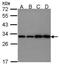 Phosphoglycerate mutase 1 antibody, PA5-22352, Invitrogen Antibodies, Western Blot image 
