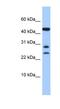 Chromosome 20 Open Reading Frame 141 antibody, NBP1-56702, Novus Biologicals, Western Blot image 