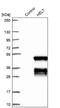 Helt BHLH Transcription Factor antibody, NBP1-90761, Novus Biologicals, Western Blot image 