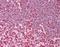 Heterogeneous nuclear ribonucleoprotein C antibody, orb96032, Biorbyt, Immunohistochemistry paraffin image 