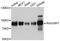 RAS Guanyl Releasing Protein 1 antibody, STJ112519, St John