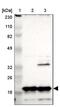 NADH:Ubiquinone Oxidoreductase Subunit B8 antibody, NBP1-88859, Novus Biologicals, Western Blot image 
