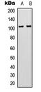 Adhesion G Protein-Coupled Receptor G3 antibody, LS-C359000, Lifespan Biosciences, Western Blot image 