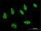 Homeodomain-interacting protein kinase 1 antibody, H00204851-M01, Novus Biologicals, Immunofluorescence image 