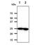 Nicotinamide N-Methyltransferase antibody, NBP2-50581, Novus Biologicals, Western Blot image 