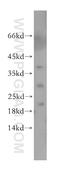 Collagen alpha-1(XVIII) chain antibody, 18301-1-AP, Proteintech Group, Western Blot image 