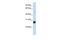 RING finger protein 186 antibody, GTX46910, GeneTex, Western Blot image 