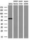 Endoglin antibody, M02997-4, Boster Biological Technology, Western Blot image 