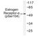 Estrogen Receptor 1 antibody, AP01581PU-N, Origene, Western Blot image 