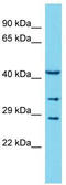 Collectin-11 antibody, TA331510, Origene, Western Blot image 