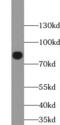 TATA-binding protein-associated factor 2N antibody, FNab08480, FineTest, Western Blot image 