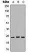 Kallikrein-6 antibody, abx121634, Abbexa, Western Blot image 