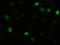 RAC-gamma serine/threonine-protein kinase antibody, TA500080, Origene, Immunofluorescence image 
