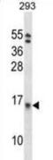 Eukaryotic Translation Initiation Factor 1B antibody, abx028390, Abbexa, Western Blot image 