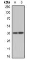 ETV7 antibody, orb341019, Biorbyt, Western Blot image 