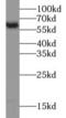 Pyruvate Kinase M1/2 antibody, FNab06496, FineTest, Western Blot image 