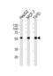 Aldehyde Dehydrogenase 6 Family Member A1 antibody, abx025199, Abbexa, Western Blot image 