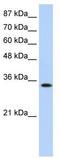 Muscleblind Like Splicing Regulator 1 antibody, TA344054, Origene, Western Blot image 