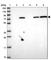 Kelch Repeat And BTB Domain Containing 6 antibody, HPA048914, Atlas Antibodies, Western Blot image 