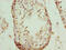 Nucleoporin 43 antibody, CSB-PA844045LA01HU, Cusabio, Immunohistochemistry paraffin image 