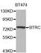 Beta-Transducin Repeat Containing E3 Ubiquitin Protein Ligase antibody, orb48295, Biorbyt, Western Blot image 