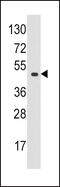 Eukaryotic Translation Initiation Factor 4A1 antibody, MBS9213371, MyBioSource, Western Blot image 