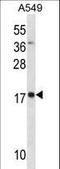 Myosin Light Chain 4 antibody, LS-C157989, Lifespan Biosciences, Western Blot image 