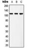 Ephrin type-B receptor 3 antibody, MBS821243, MyBioSource, Western Blot image 