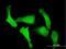 Importin 5 antibody, H00003843-B01P, Novus Biologicals, Immunocytochemistry image 