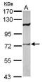 Very long-chain acyl-CoA synthetase antibody, PA5-30420, Invitrogen Antibodies, Western Blot image 