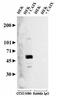 Carbonic Anhydrase 9 antibody, GTX15086, GeneTex, Western Blot image 