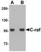 Raf-1 Proto-Oncogene, Serine/Threonine Kinase antibody, TA319697, Origene, Western Blot image 