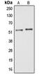 Armadillo Repeat Containing 6 antibody, LS-C353601, Lifespan Biosciences, Western Blot image 