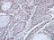 FA Complementation Group D2 antibody, GTX116037, GeneTex, Immunohistochemistry paraffin image 