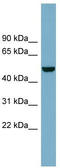 Colony Stimulating Factor 1 antibody, TA335258, Origene, Western Blot image 