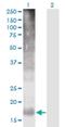 Transmembrane 4 L Six Family Member 4 antibody, H00007104-M03, Novus Biologicals, Western Blot image 