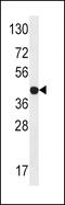 STE20-related kinase adapter protein alpha antibody, 62-683, ProSci, Western Blot image 