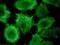 Keratin, type I cytoskeletal 17 antibody, DM127P, Origene, Immunofluorescence image 