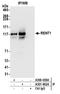 UPF1 RNA Helicase And ATPase antibody, A301-902A, Bethyl Labs, Immunoprecipitation image 